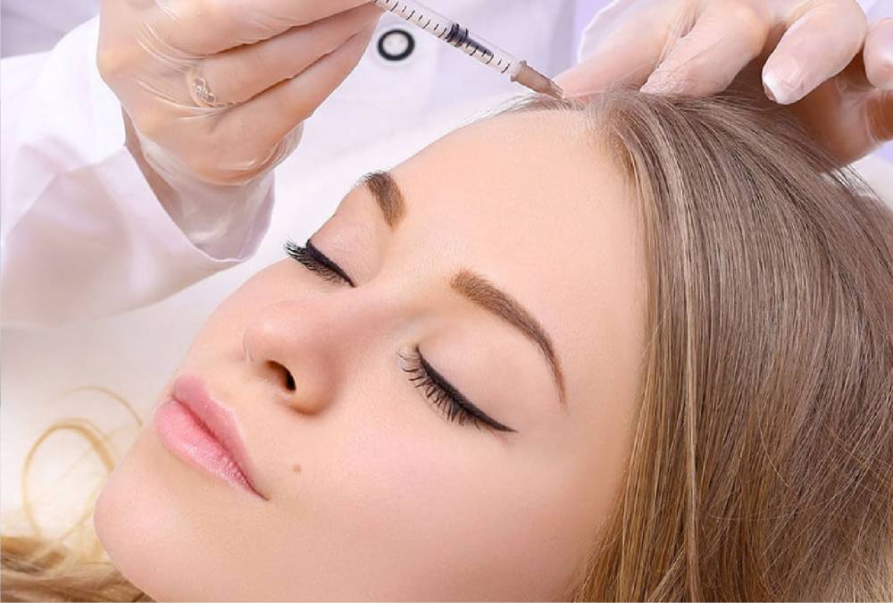 مزوتراپی مو